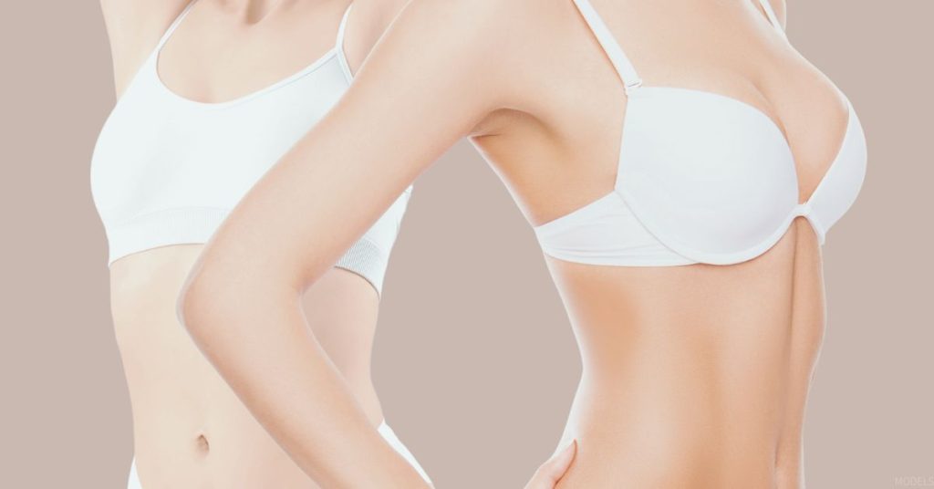 Side-by-side comparison of breast lift and breast implant surgical outcomes (models).